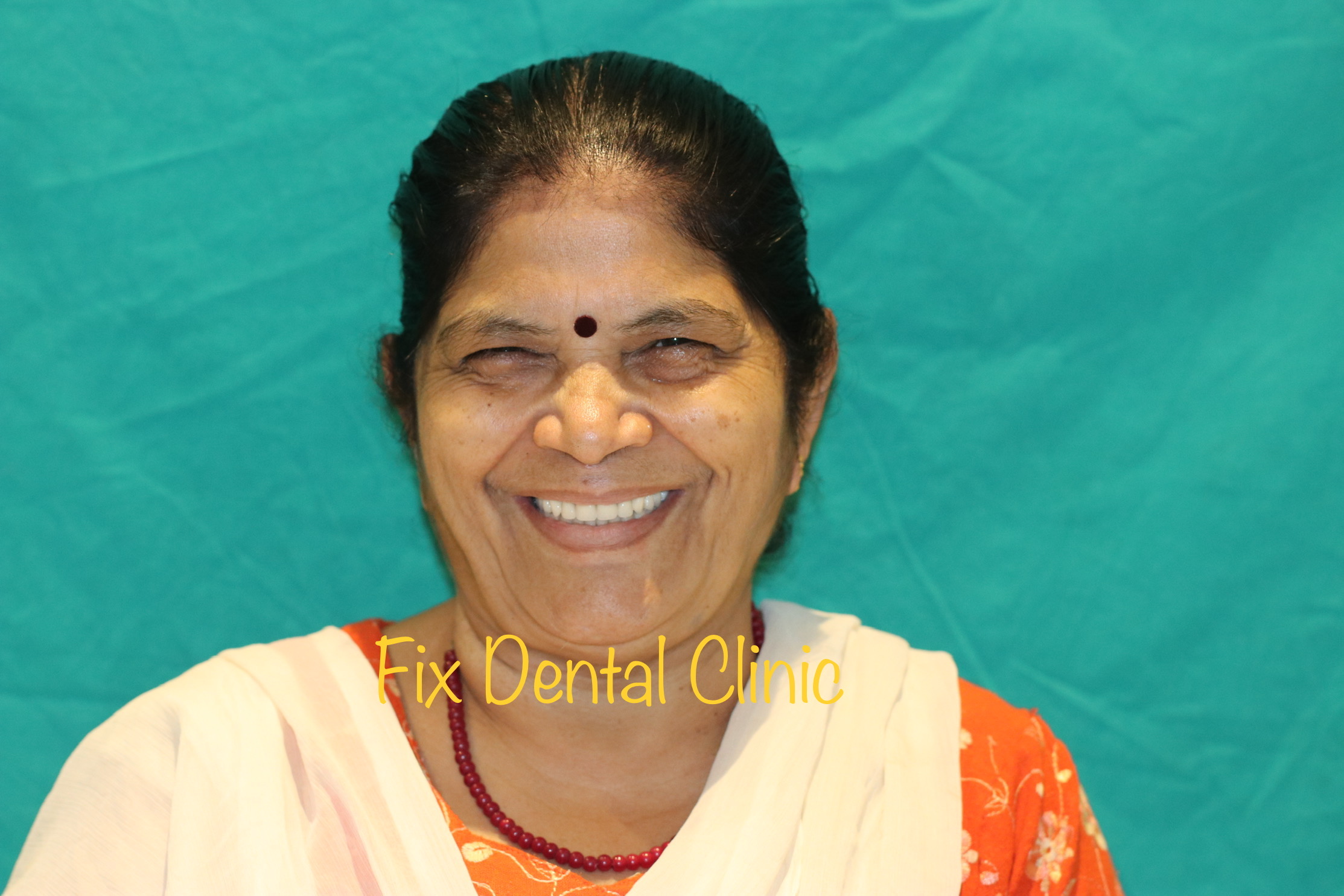 After - Advanced smile enhancement