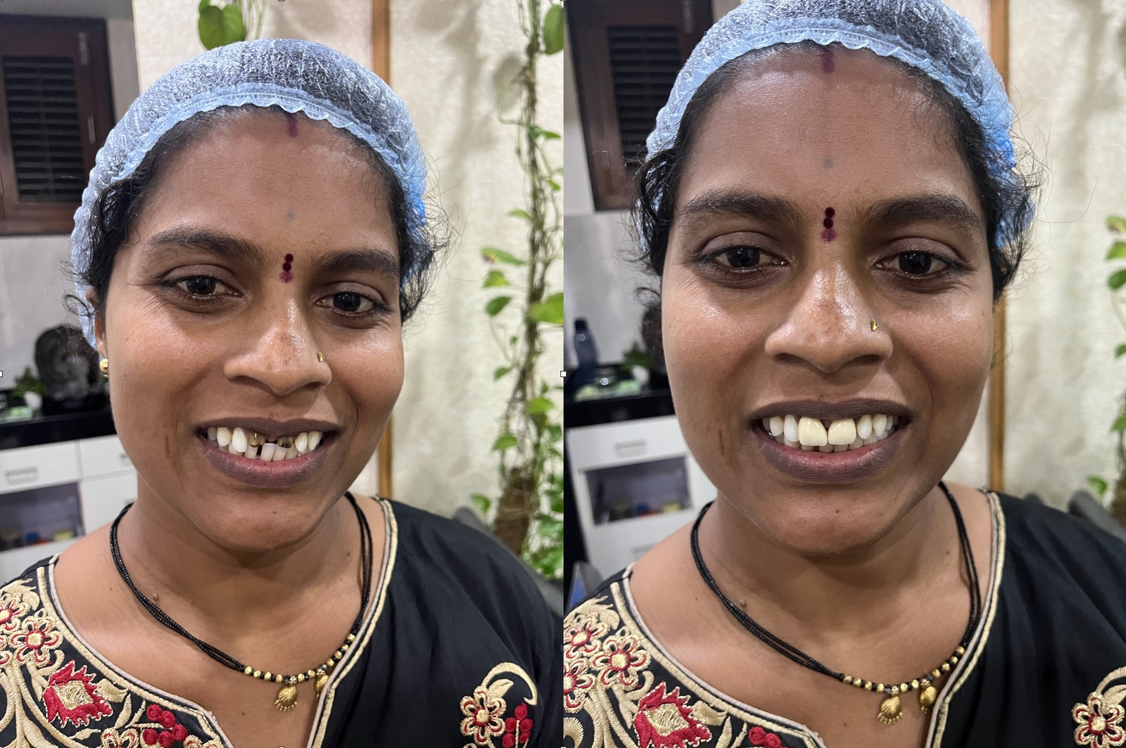 Alignment Correction