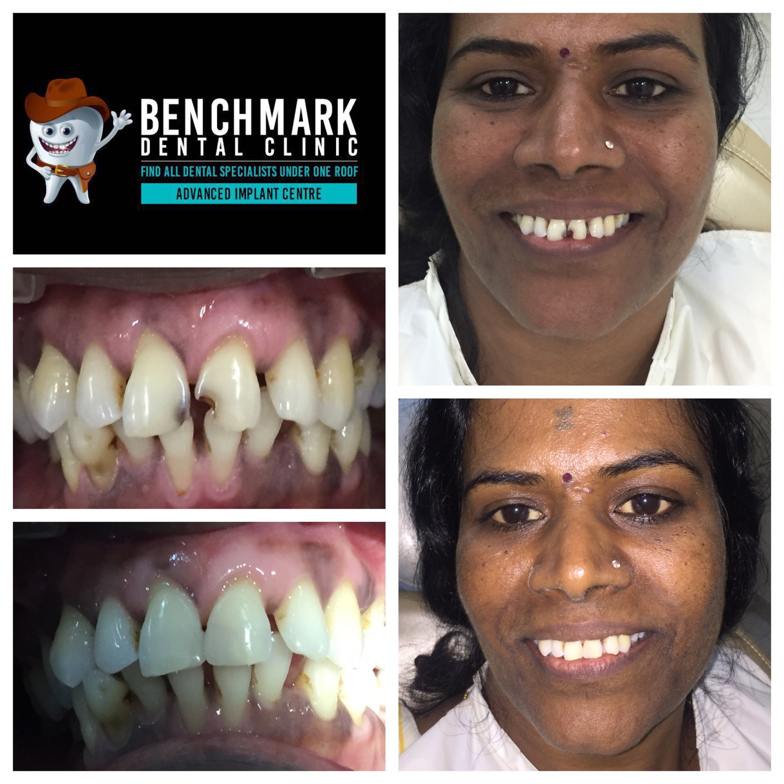 Complete Restoration