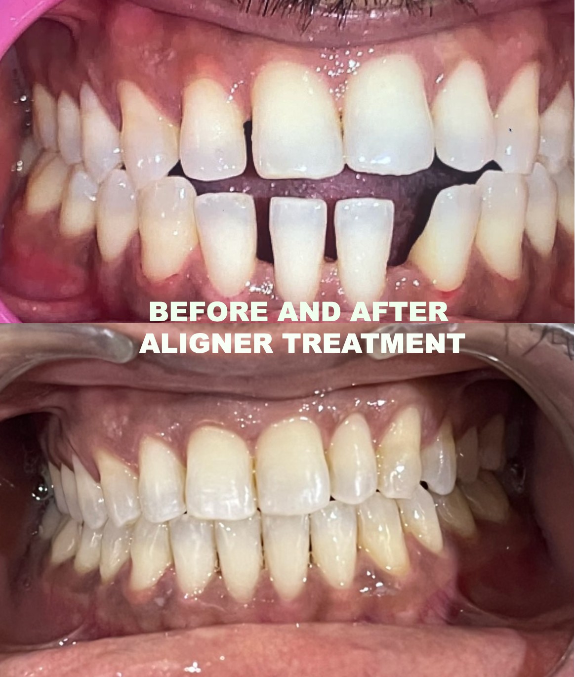 Aesthetic Enhancement