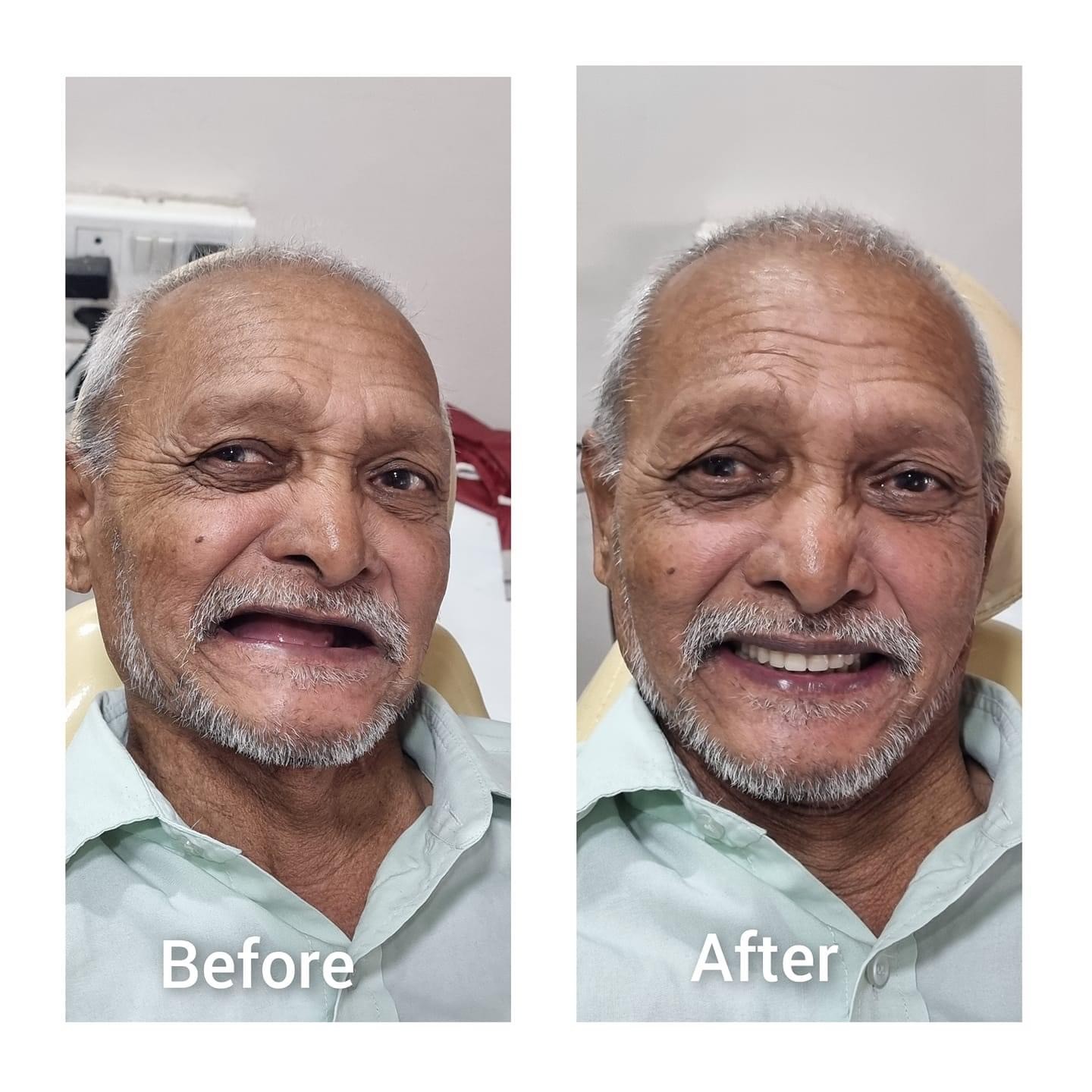 Comprehensive Makeover