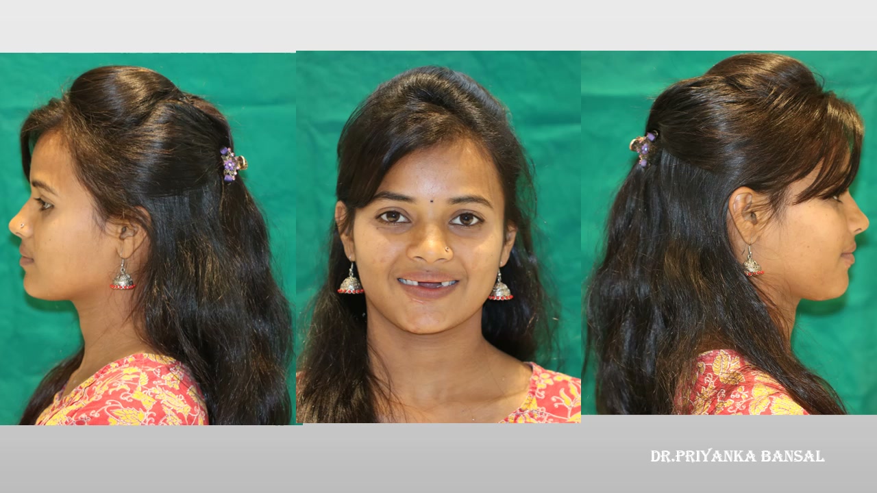 Sharada - Dental Transformation
