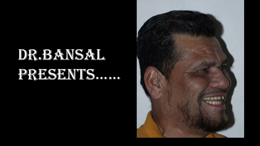 Shaikh - Complete Treatment