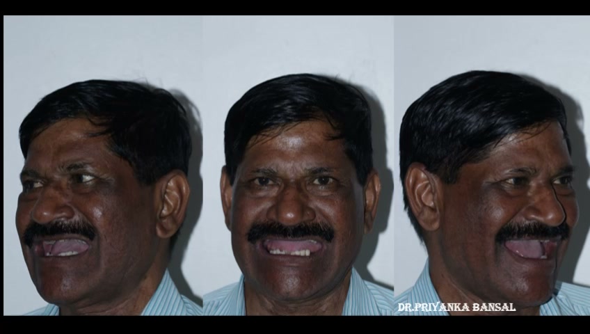 Patient Story - Life-Changing Results